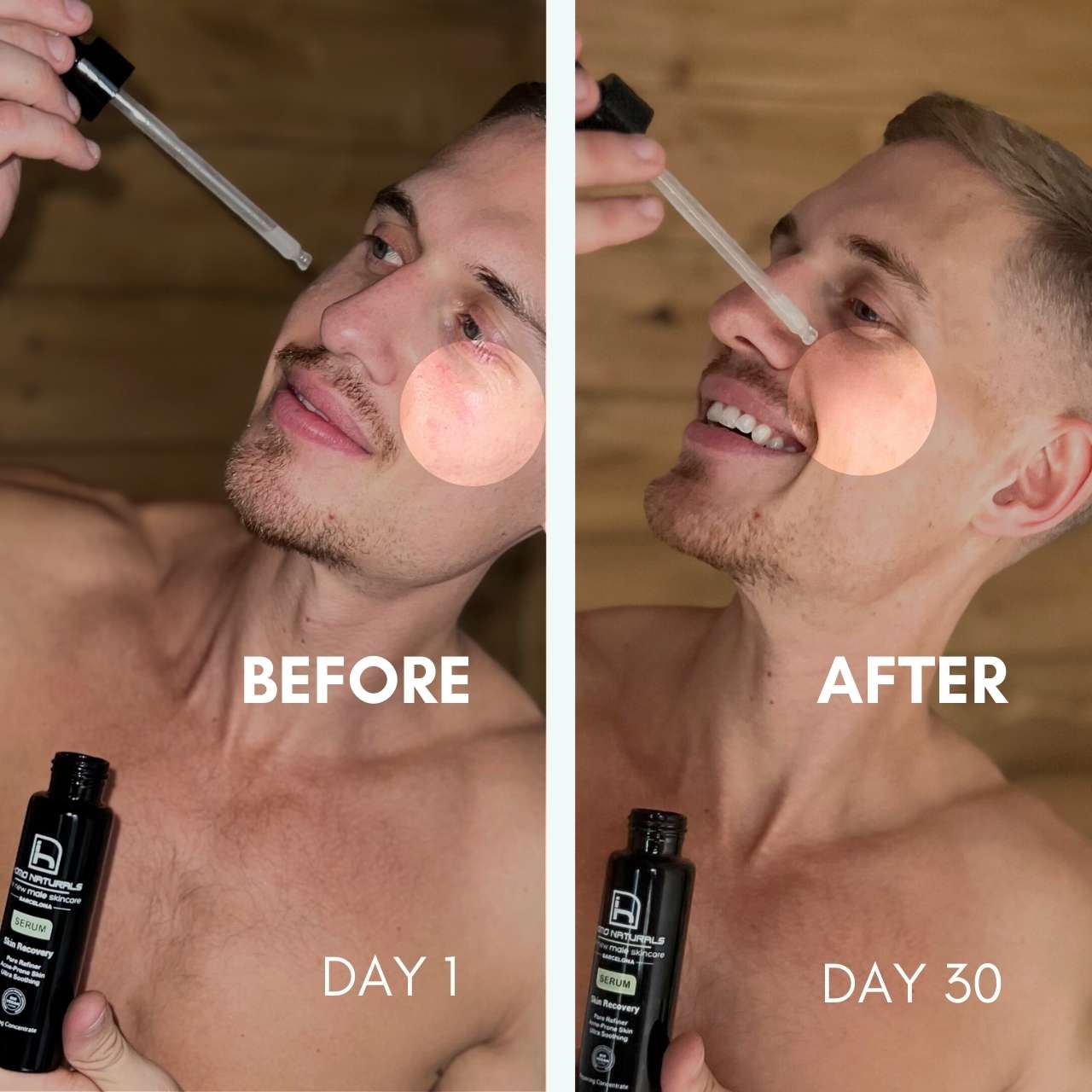 Serum facial hombre para piel irritada y sensible, enrojecida y deshidratada. Natural, bio y vegano.