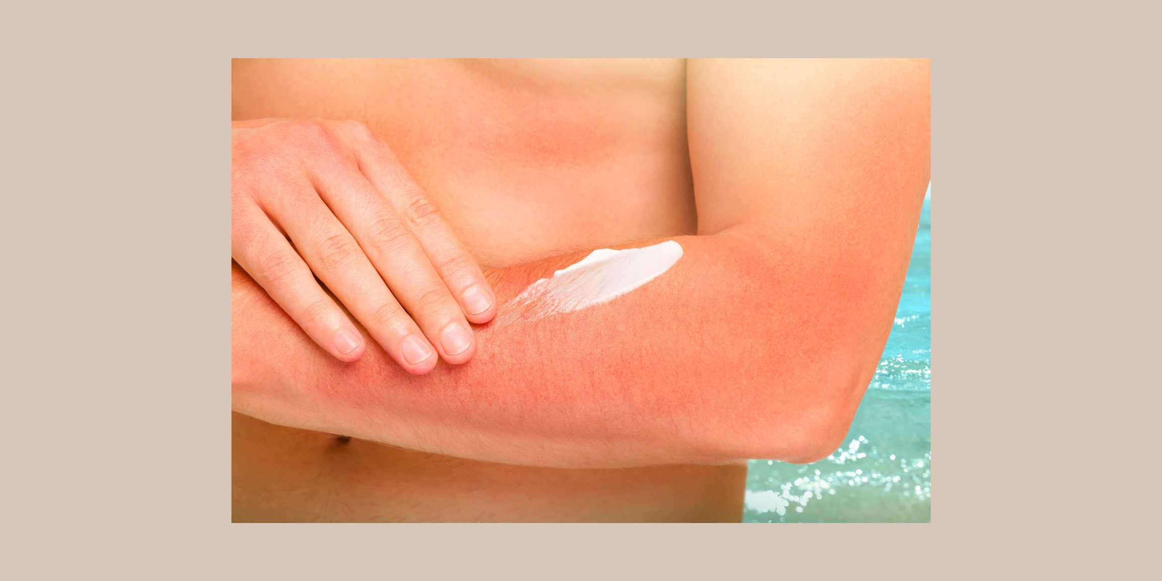 Como elegir un protector solar natural para hombre